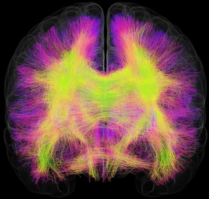 Vos routes carburent!<br>(mtabolisme du connectome chez une personne Alzheimer)